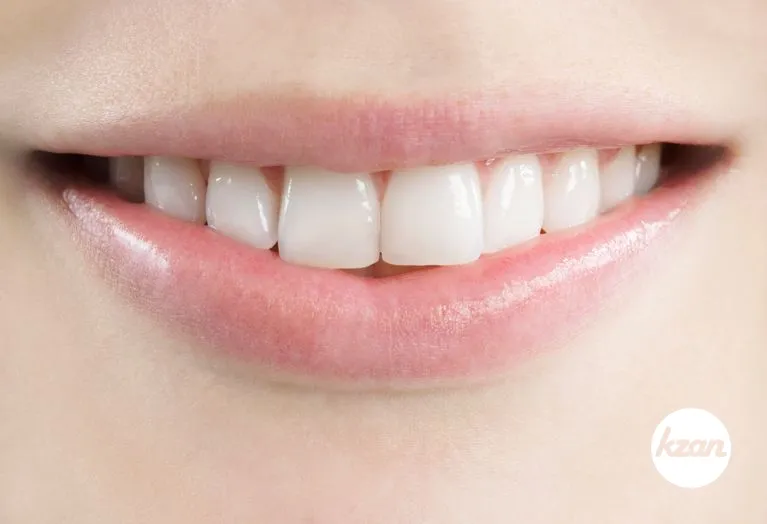 Close up of a young woman's perfect smile.